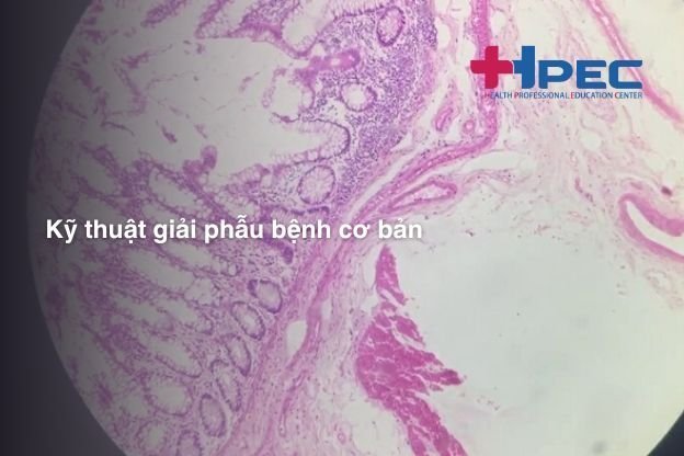 Kỹ thuật giải phẫu bệnh cơ bản