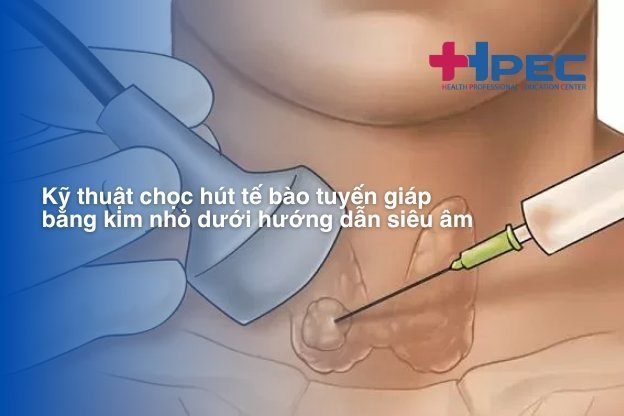 Kỹ thuật chọc hút tế bào tuyến giáp bằng kim nhỏ dưới hướng dẫn siêu âm (1)